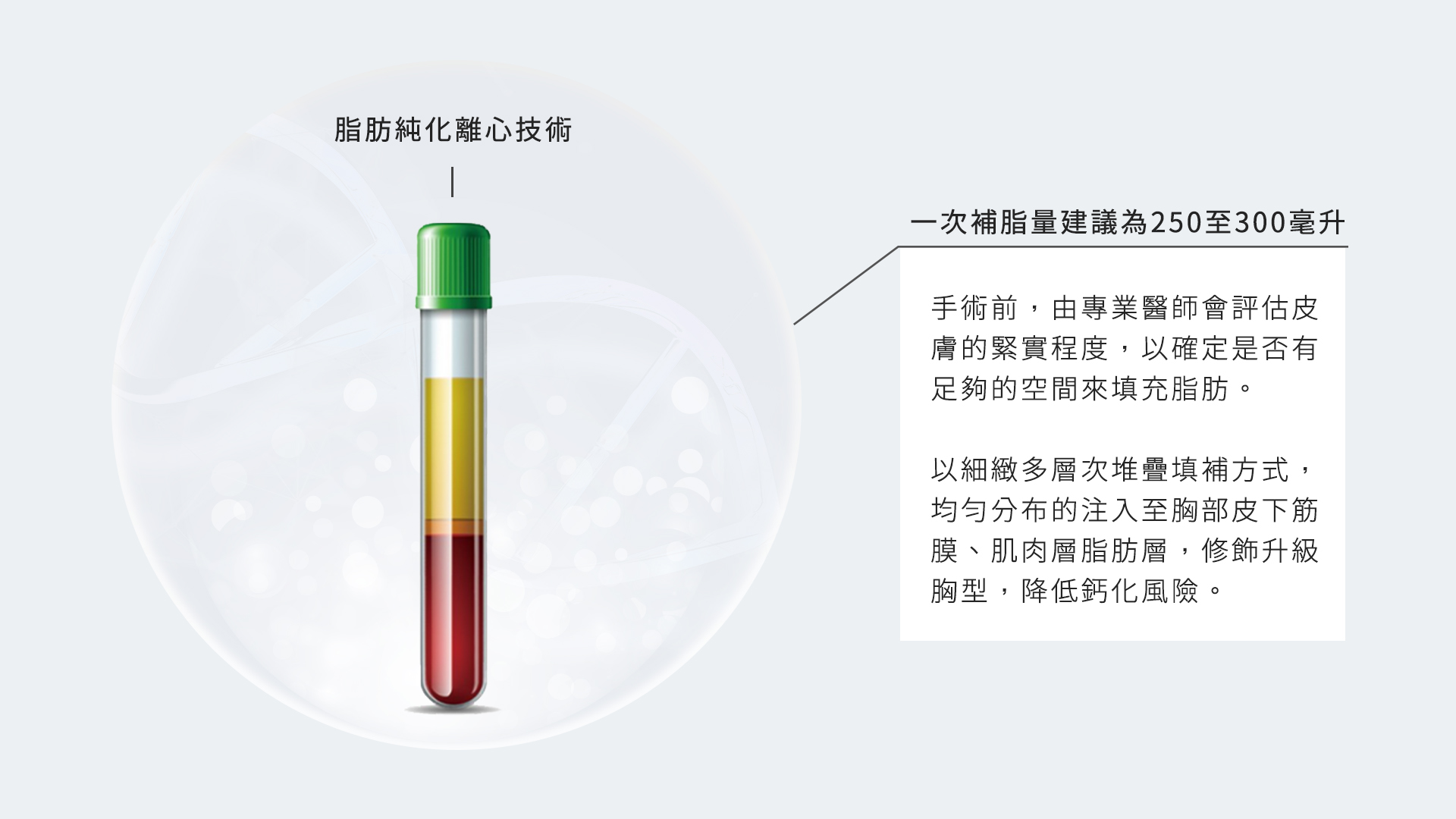 自體脂肪隆乳脂肪移植用於隆乳手術的流程_自體脂肪隆乳