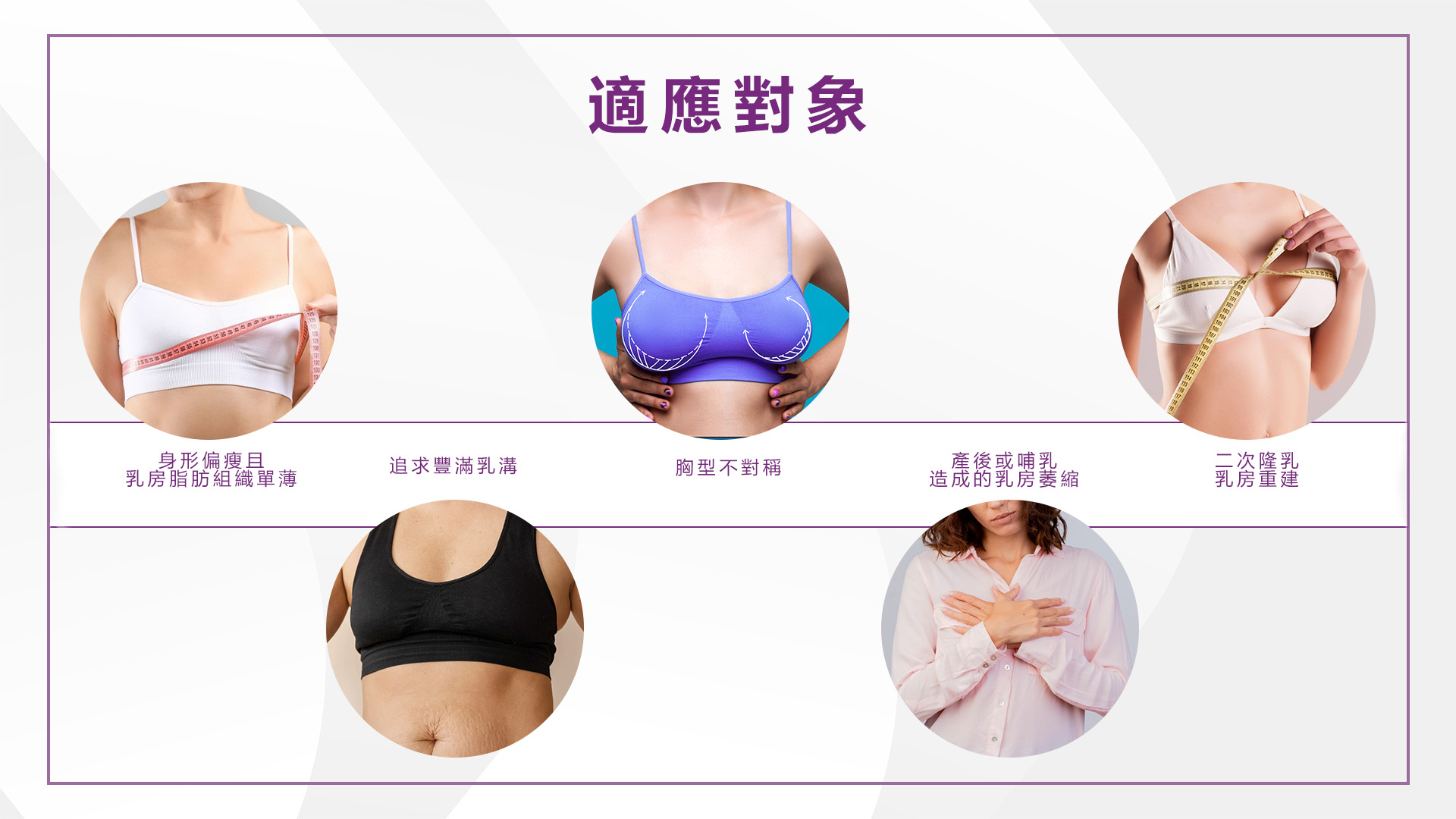 高雄Motiva魔滴2.0隆乳手術權威醫師推薦價格費用008