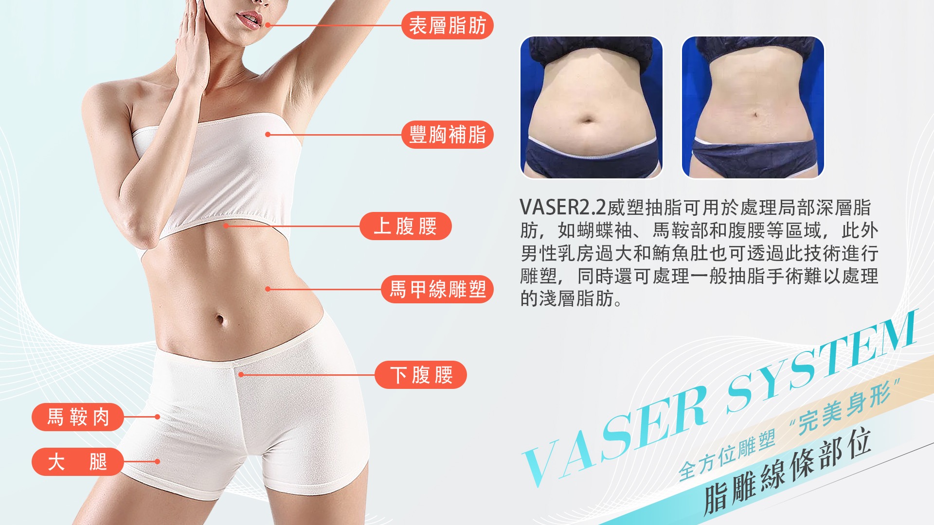 高雄台南Vaser2.2威塑抽脂004