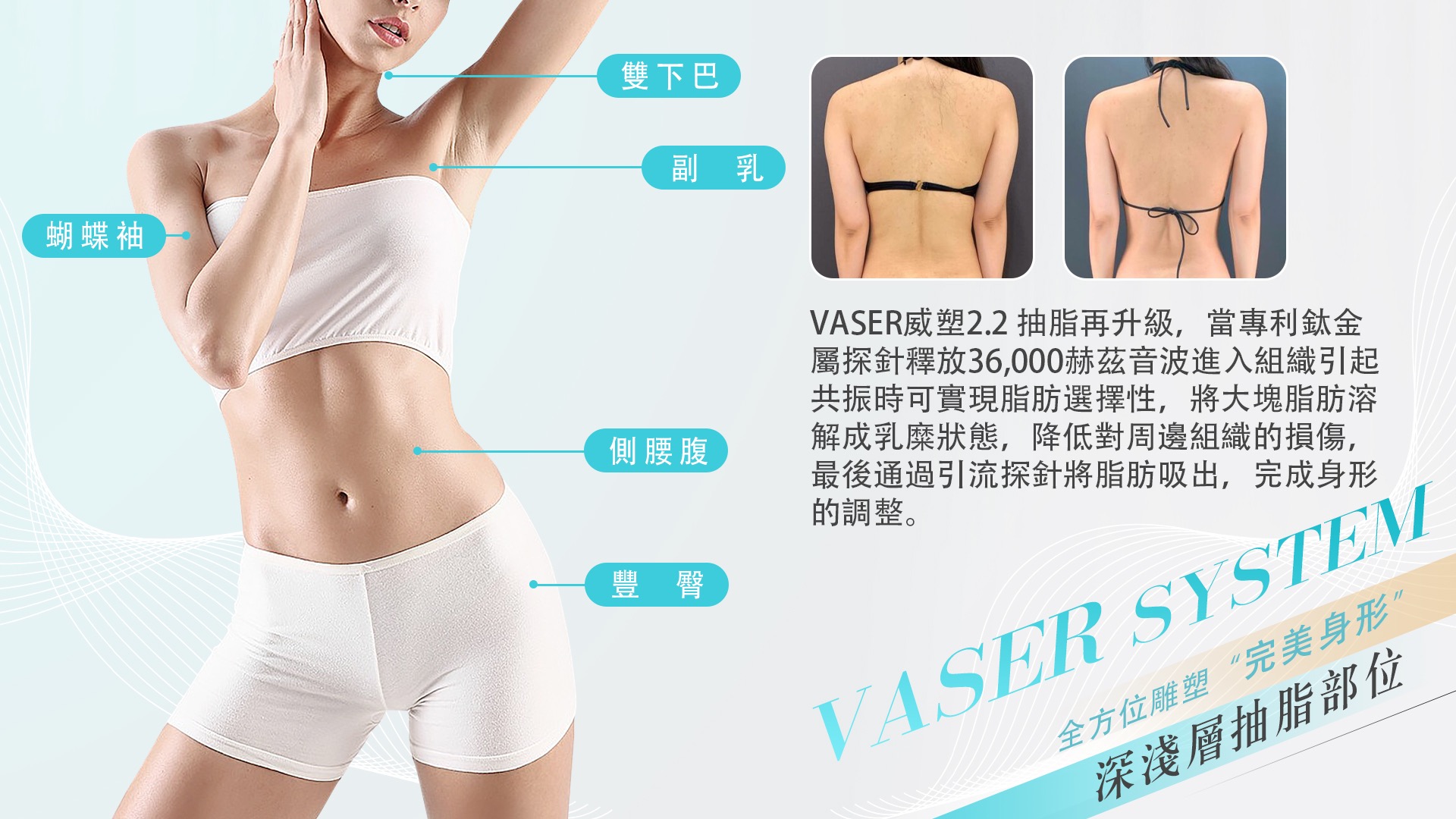 高雄台南Vaser2.2威塑抽脂008