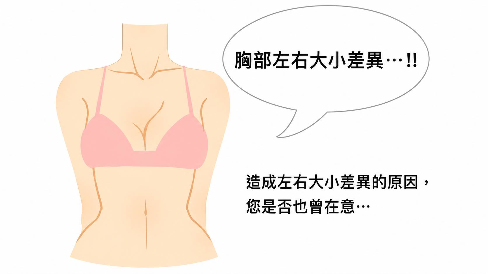 高雄隆乳失敗問題左右大小高低不對稱Dr.邱智弘醫師隆乳權威能重建