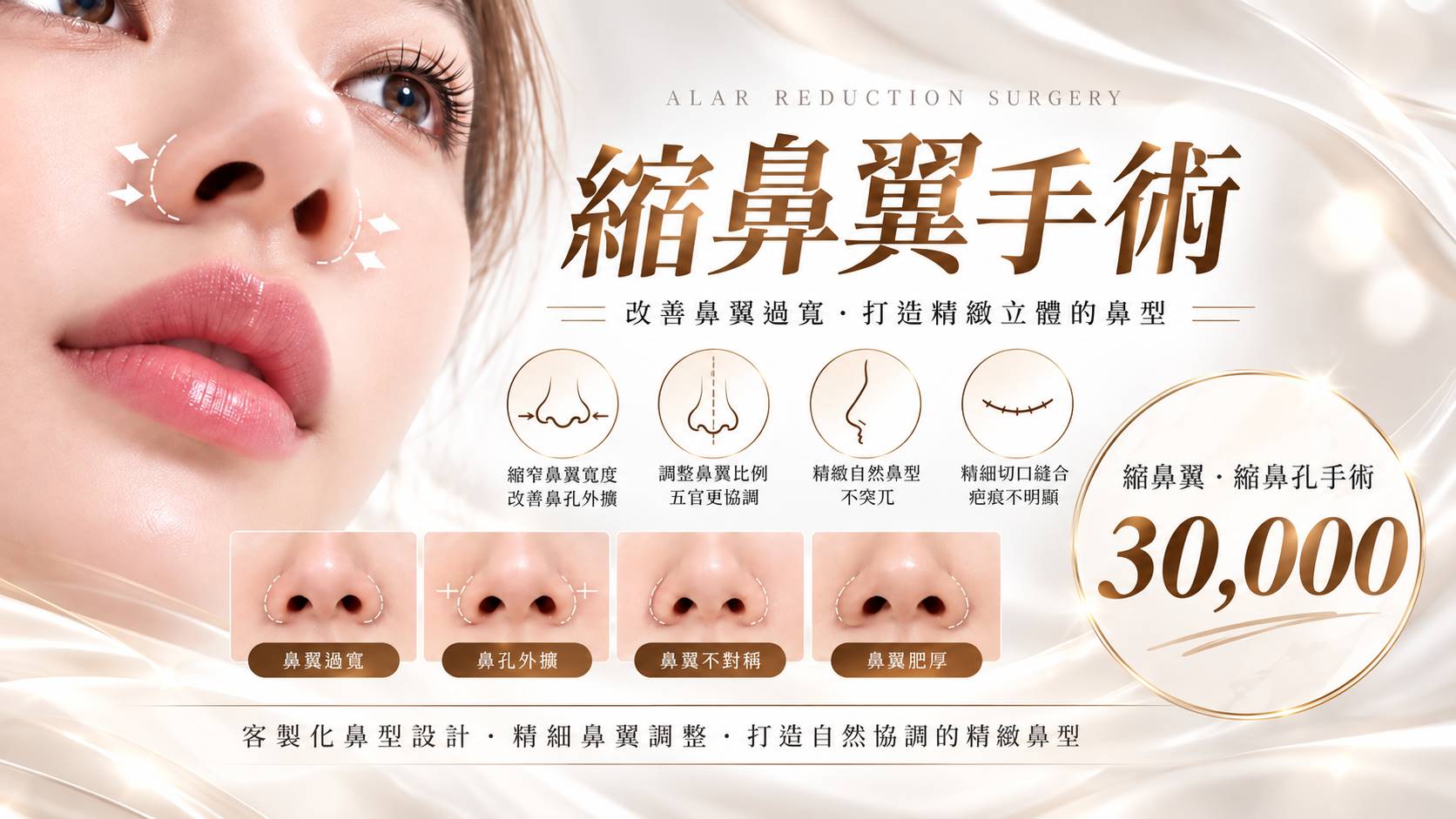 高雄縮鼻翼縮鼻孔手術權威醫師推薦價格費用多少001